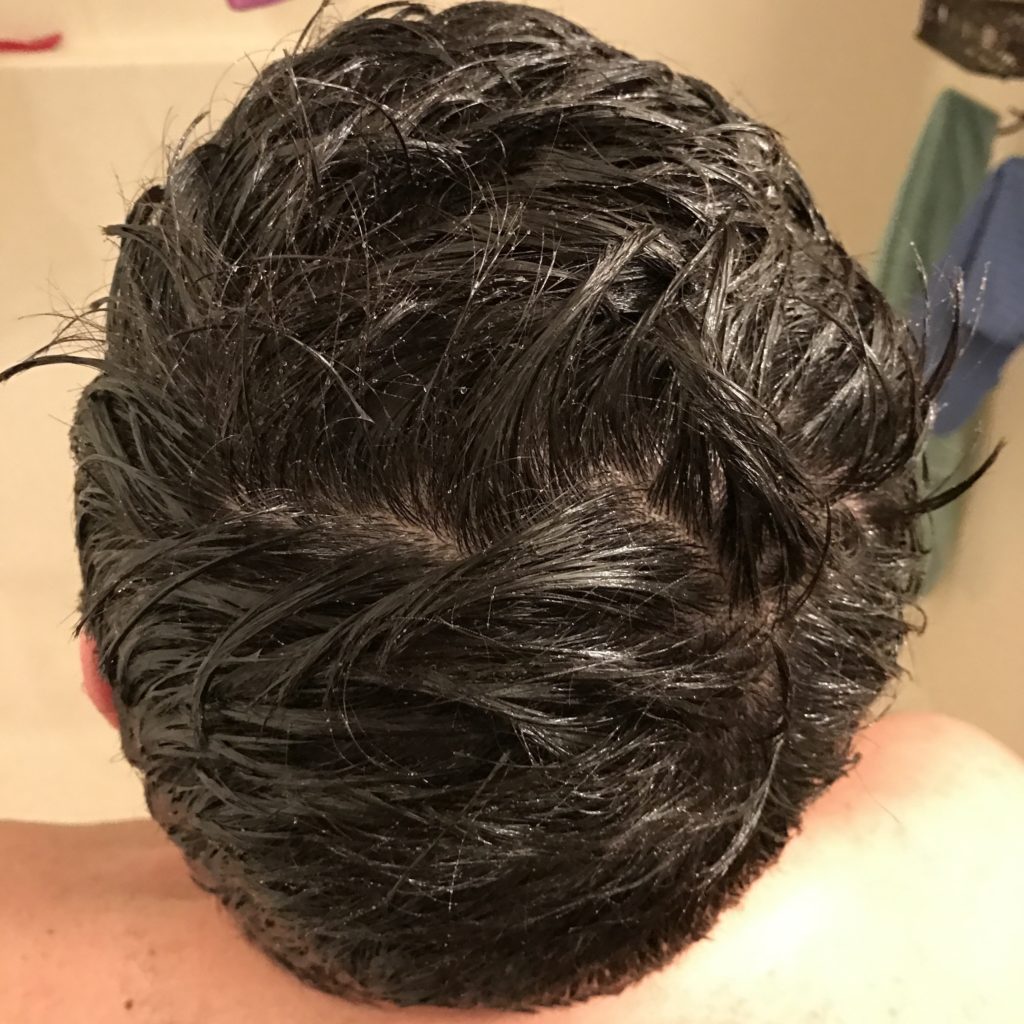 DIY Dry Scalp Treatment