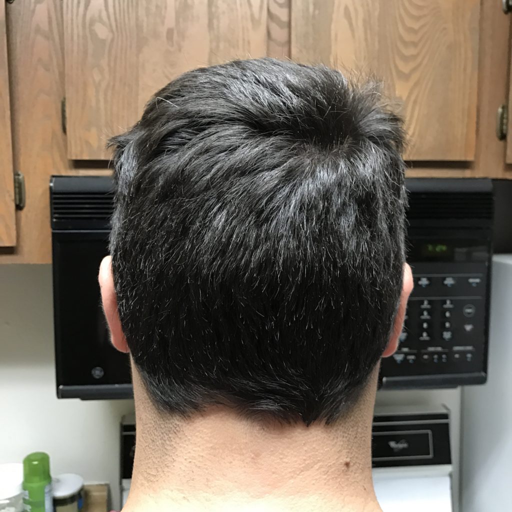 DIY Dry Scalp Treatment